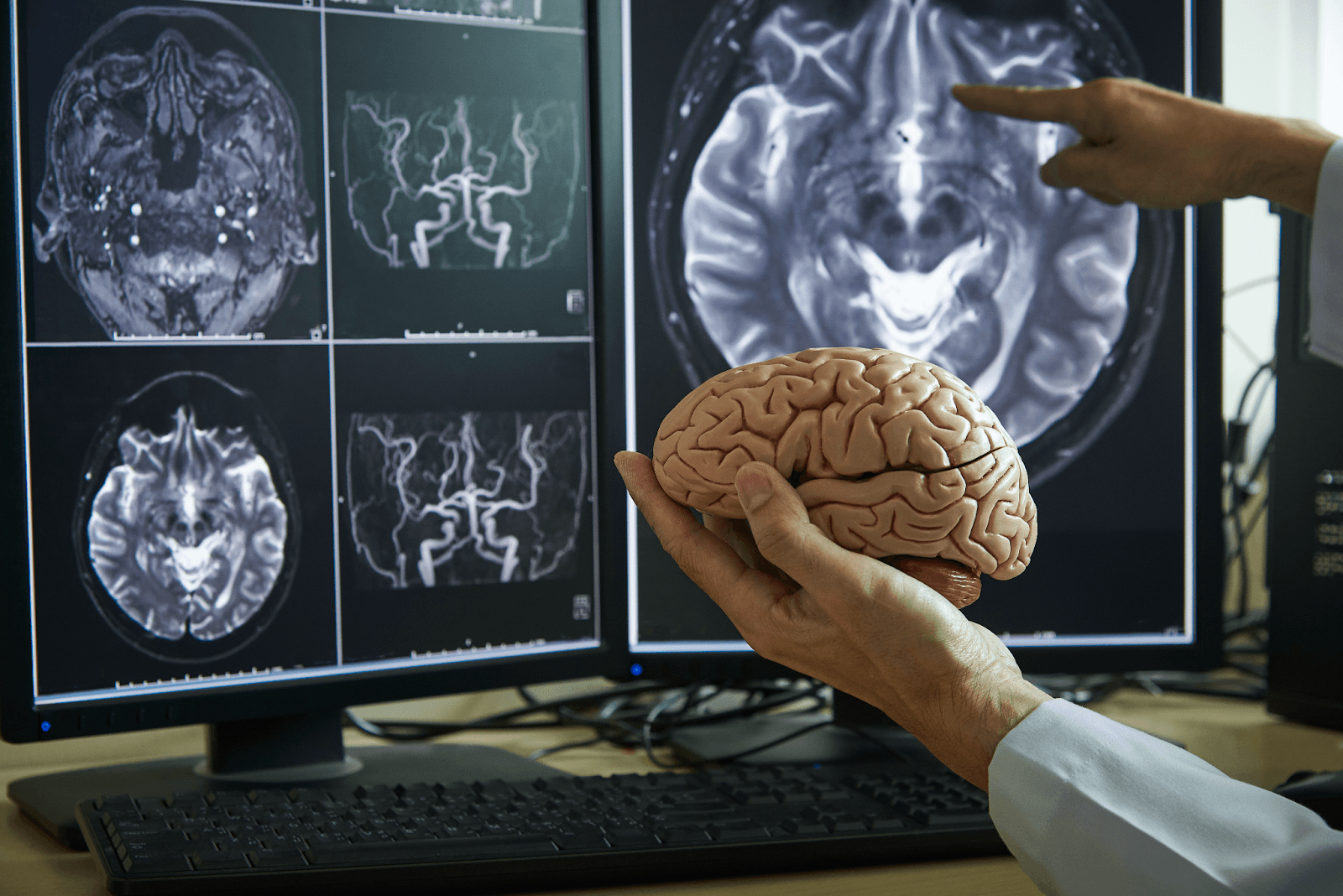 Neurologia